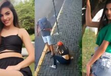 Mulher teria jogado ácido no rosto de jovem por suposto ciúme do ex-marido