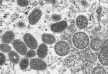 OMS classifica surto de varíola dos macacos como emergência global de saúde